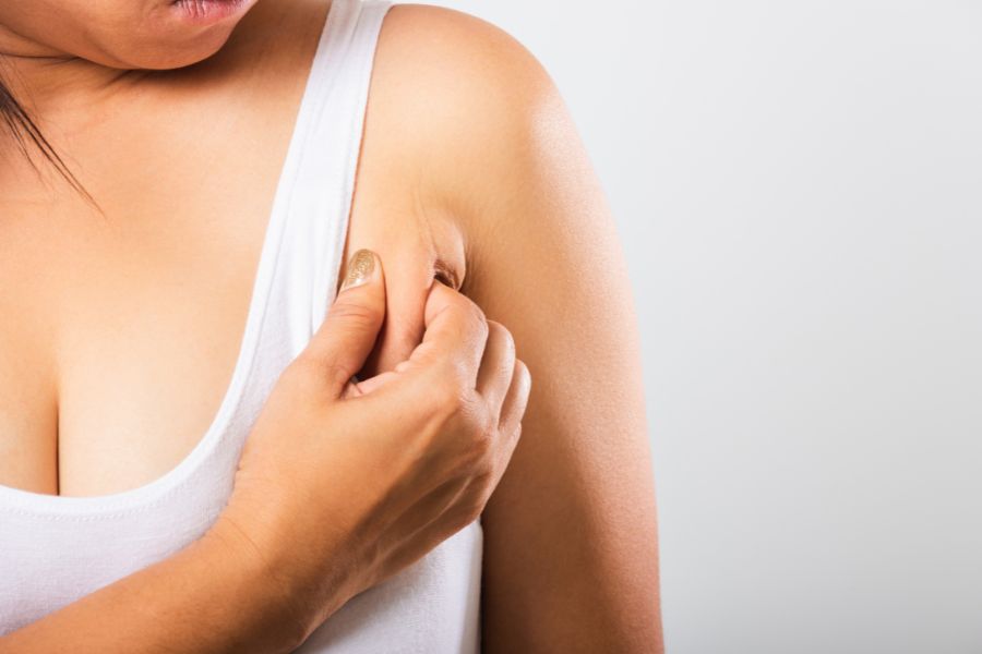 Ai nên hút mỡ nách