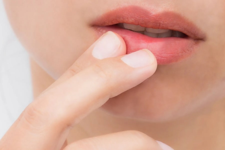 Kinh nghiệm cắt môi trái tim đẹp và đạt hiệu quả như mong muốn