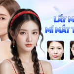 lấy mỡ mí mắt