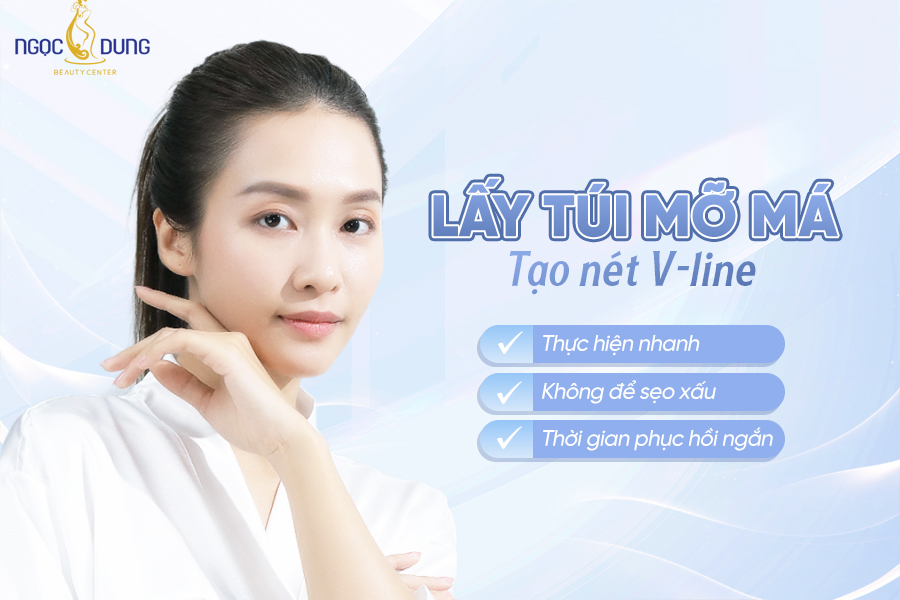 Lấy túi mỡ má