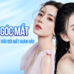 Mở góc mắt tại Ngọc Dung - Bí quyết sở hữu đôi mắt hoàn hảo