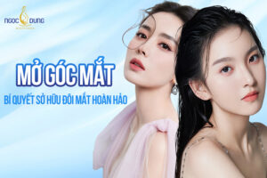 Mở góc mắt tại Ngọc Dung - Bí quyết sở hữu đôi mắt hoàn hảo