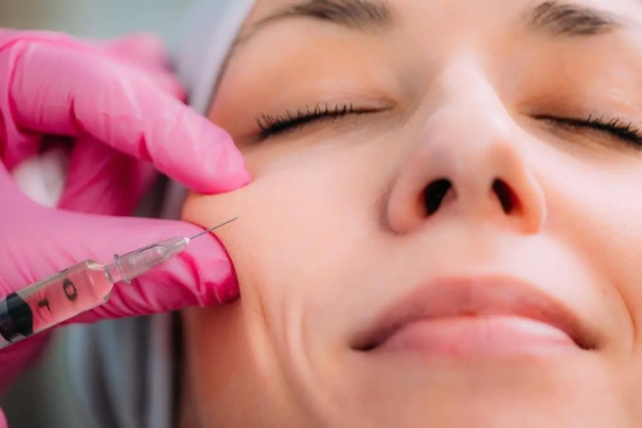 Nâng gò má bằng chất làm đầy