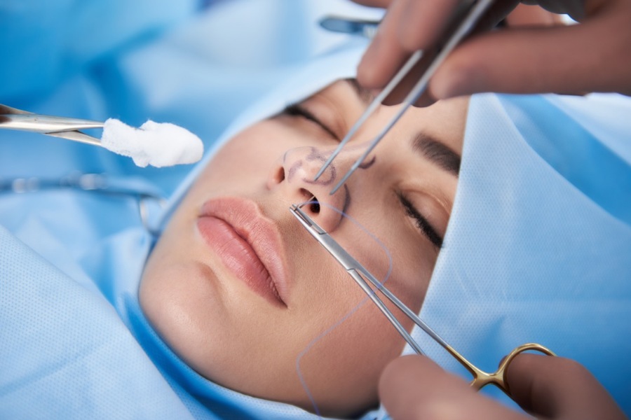 Quy trình nâng mũi bằng sụn tự thân