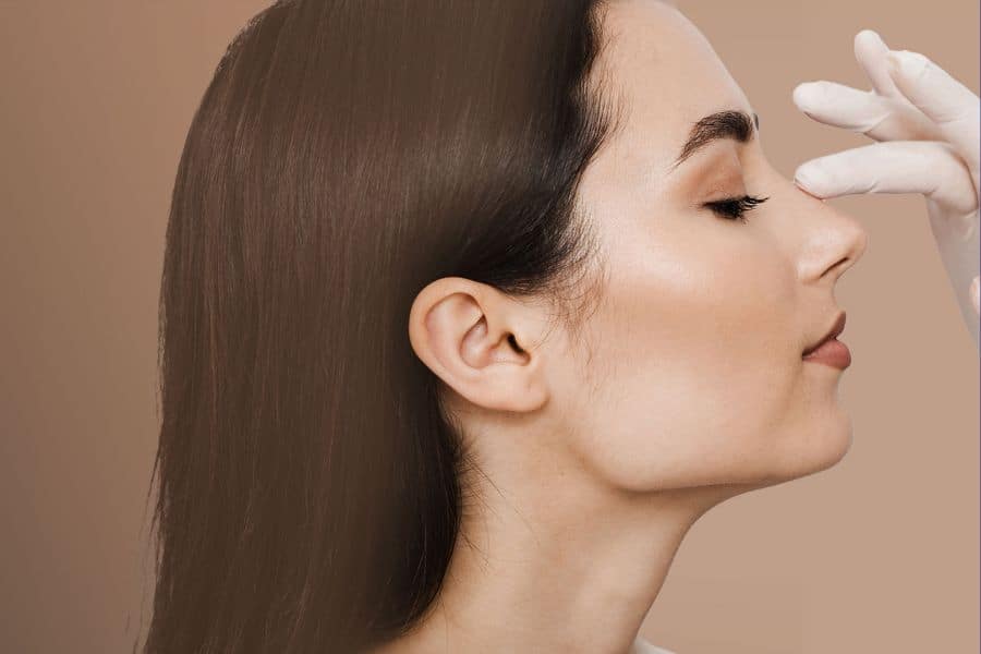 Nâng mũi tự thân Ngọc Dung: Thay dáng mũi, đổi vận mệnh 7 nâng mũi bằng sụn tự thân hoàn toàn