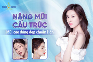 Nâng mũi cấu trúc