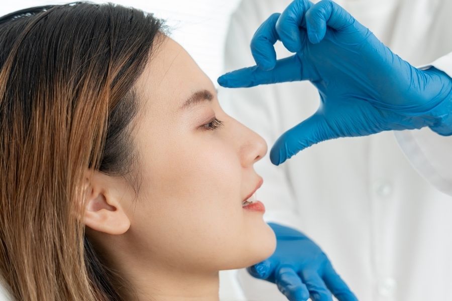 nâng mũi cấu trúc có vĩnh viễn không