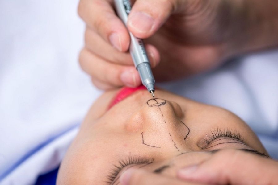 Mức giá cho một ca nâng mũi thường dao động từ 45 - 80 triệu đồng