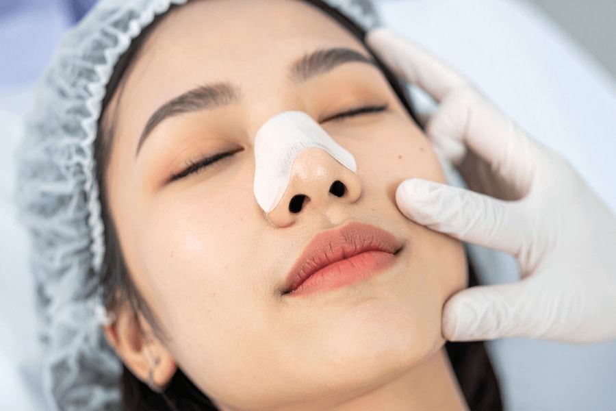 Nâng mũi S line là gì? Tại sao lại được chị em ưa chuộng 16 nâng mũi s line là gì