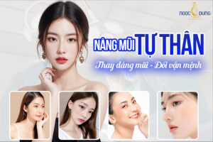 Nâng mũi tự thân - Thay dáng nũi, đổi vận mệnh