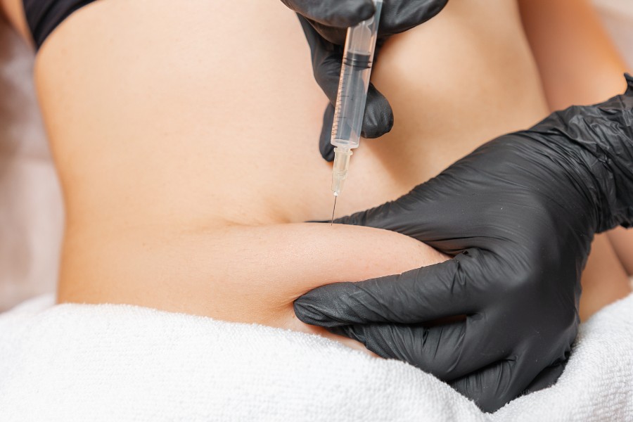 Quy trình cấy mỡ tự thân thực hiện khá nhanh gọn an toàn