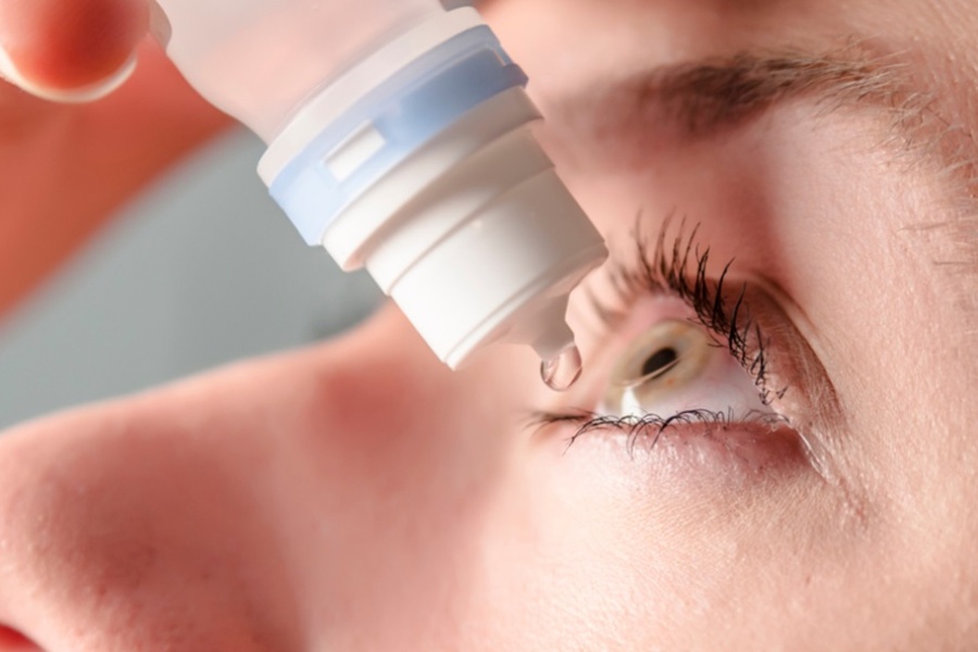 Nhỏ mắt 3-5 lần mỗi ngày bằng thuốc nhỏ mắt để giữ cho mắt luôn sạch sẽ và tránh bị khô