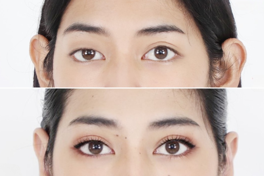 Tạm biệt đôi mắt khuyết điểm, chào đón đôi mắt 2 mí hoàn hảo cùng BVTM Ngọc Dung