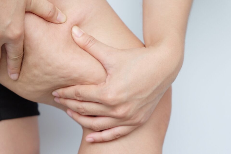 Những người thừa có mỡ thừa vùng đùi nên có thể thực hiện hút mỡ đùi