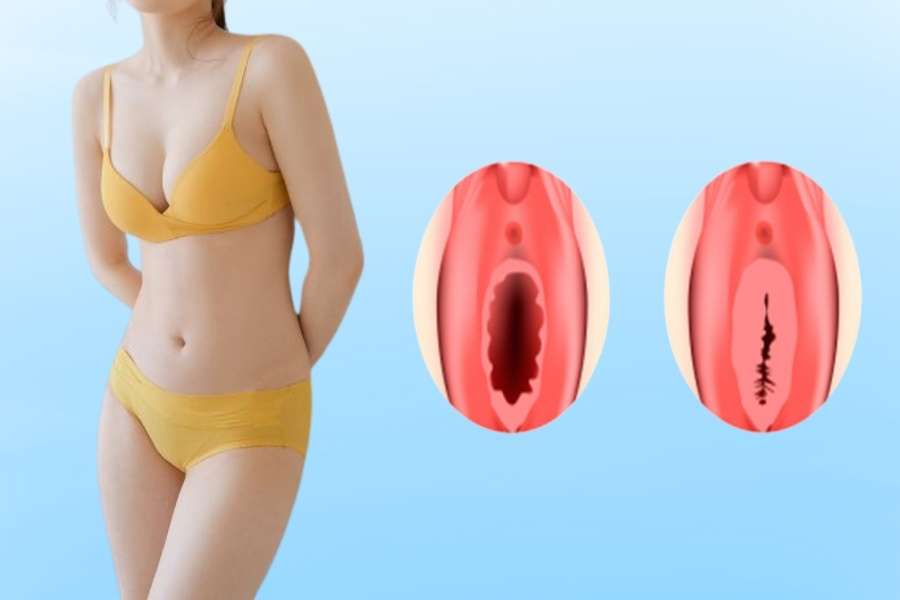 Vá trinh mang lại nhiều lợi ích cho phụ nữ, cả về mặt tâm lý và sức khỏe