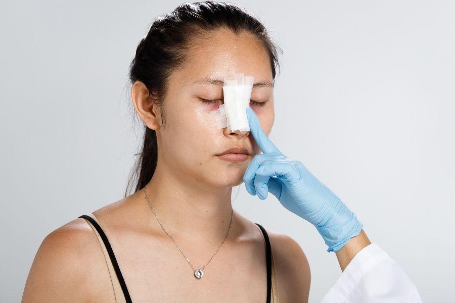 Nâng mũi cấu trúc Cho dáng mũi cao đẹp chuẩn Hàn 10 Nhược điểm sau nâng mũi