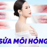 Phẫu thuật sửa môi hỏng - Hành trình tìm lại nụ cười tự tin cùng BVTM Ngọc Dung