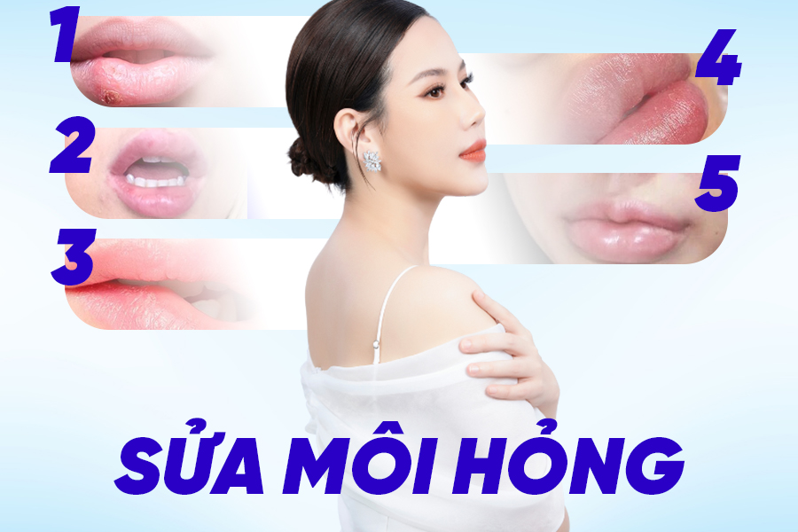 Phẫu thuật sửa môi hỏng - Hành trình tìm lại nụ cười tự tin cùng BVTM Ngọc Dung