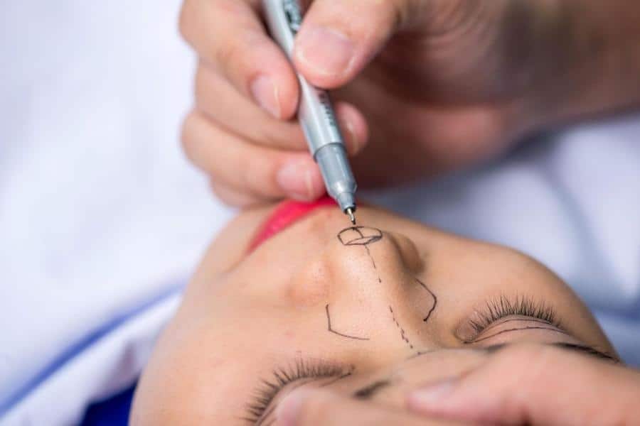 Nâng mũi S line là gì? Tại sao lại được chị em ưa chuộng 14 phương pháp nâng mũi s line