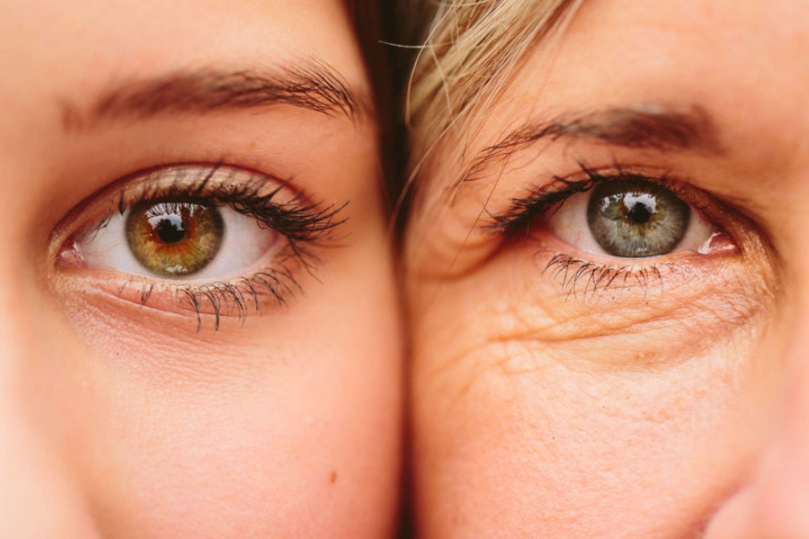 Cắt mí dưới mang đến giải pháp hoàn hảo cho những ai mong muốn sở hữu đôi mắt trẻ trung, rạng rỡ