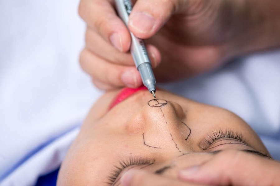 Bác sĩ tiến hành đo vẽ dàng mũi sao cho hài hòa với khuôn mặt