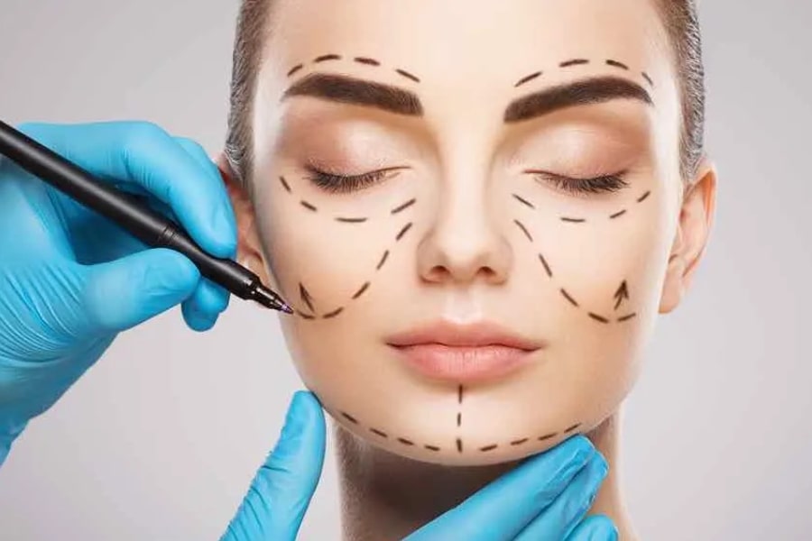 Quy trình thực hiện phẫu thuật nâng xương gò má