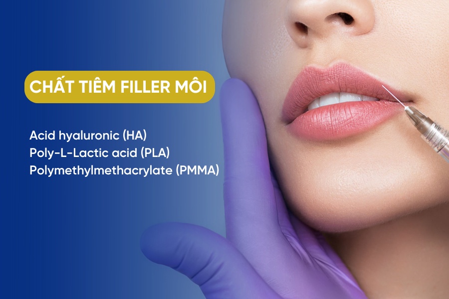 Acid hyaluronic (HA), acid poly-L-lactic (PLLA) và polymethylmethacrylate (PMMA) là 3 chất tiêm filler được sử dụng phổ biến nhất