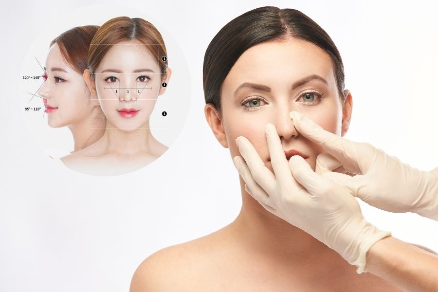 Nâng mũi cấu trúc