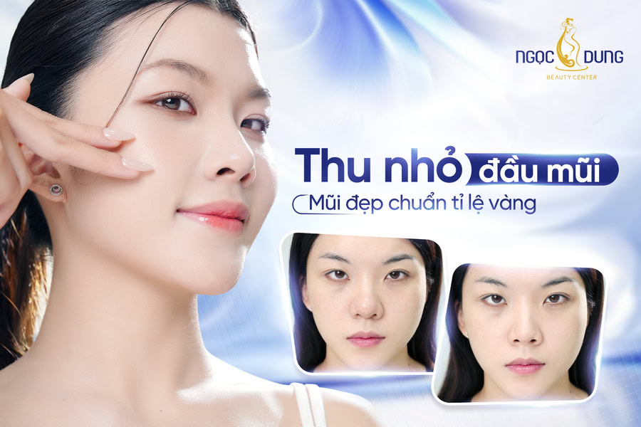 Phẫu thuật thu nhỏ đầu mũi là tiểu phẫu khắc phục đầu mũi to, thô