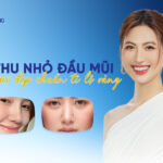 thu nhỏ đầu mũi