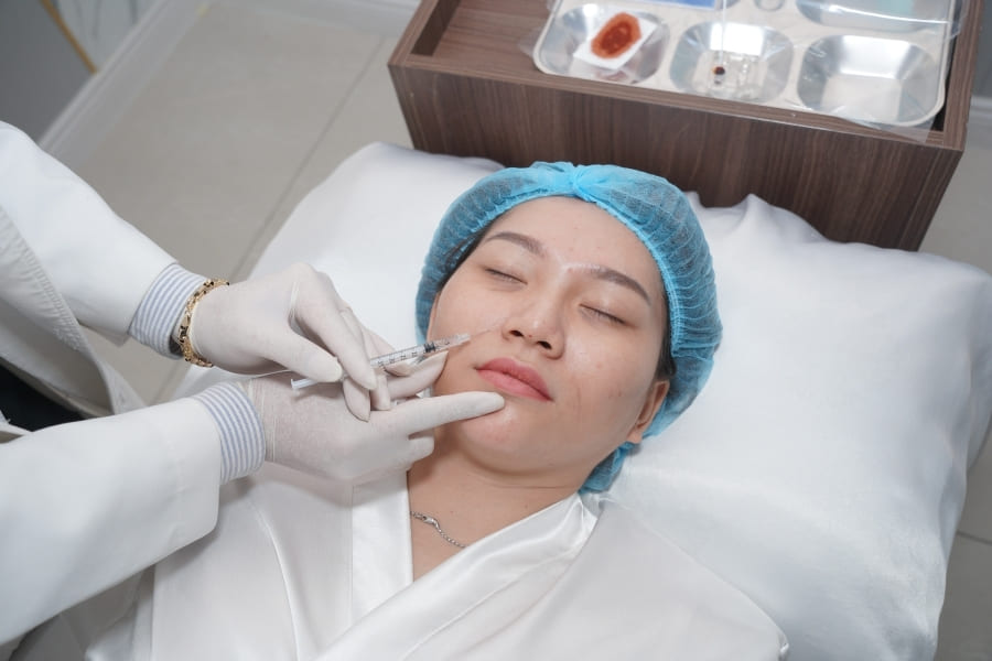 Tiêm Filler làm đầy rãnh cười bằng HA 