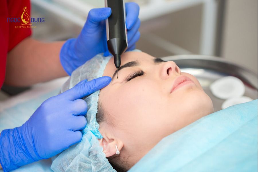 Nhấn mí mắt: Thông tin cần biết từ A–Z trước khi nhấn mí 16 Tuân thủ các nguyên tắc vàng giúp đôi mắt sau bấm mí đạt độ tự nhiên, cuốn hút