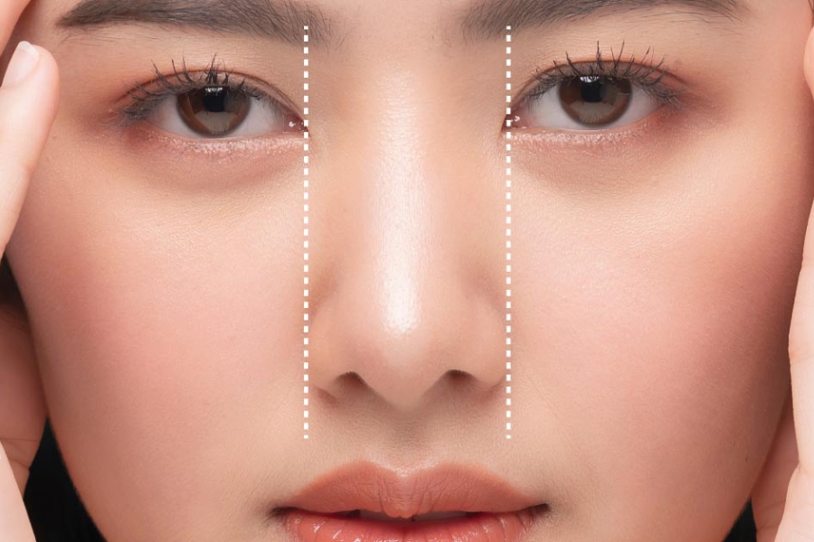Thu nhỏ đầu mũi giúp gương mặt sắc nét, tươi tắn hơn