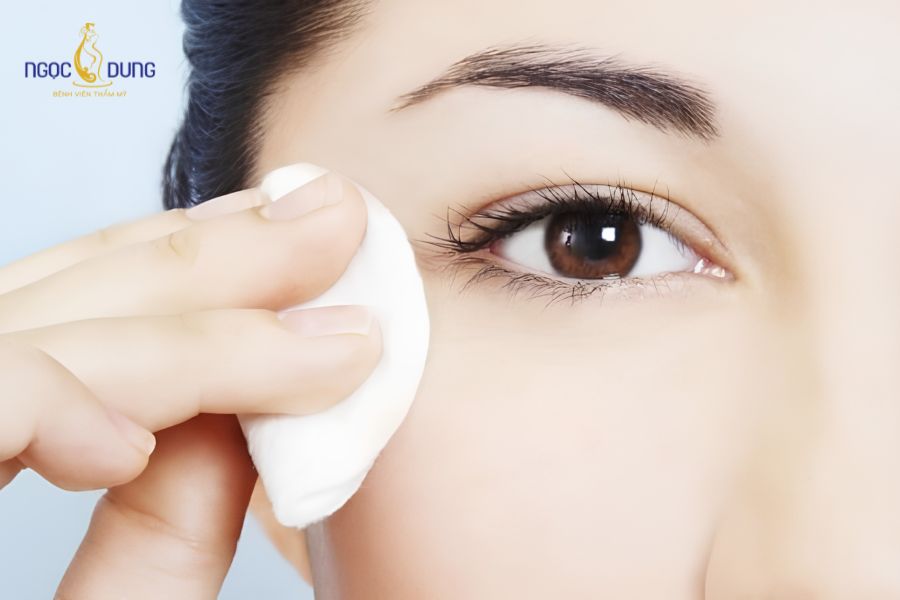 Nhấn mí mắt: Thông tin cần biết từ A–Z trước khi nhấn mí 17 Về chế độ vệ sinh và sinh hoạt sau khi nhấn mí