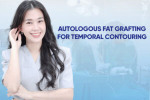 Autologous fat grafting for temporal contouring at Ngọc Dung aesthetic Hospital