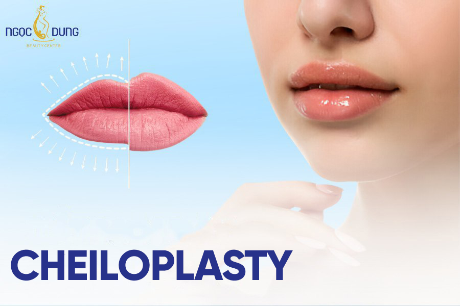 Cheiloplasty: an overview of advantages and procedure