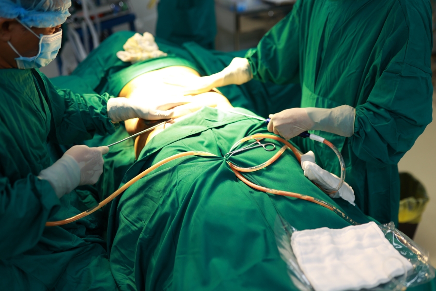 Liposuction advantages at Ngoc Dung