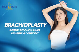 Brachioplasty