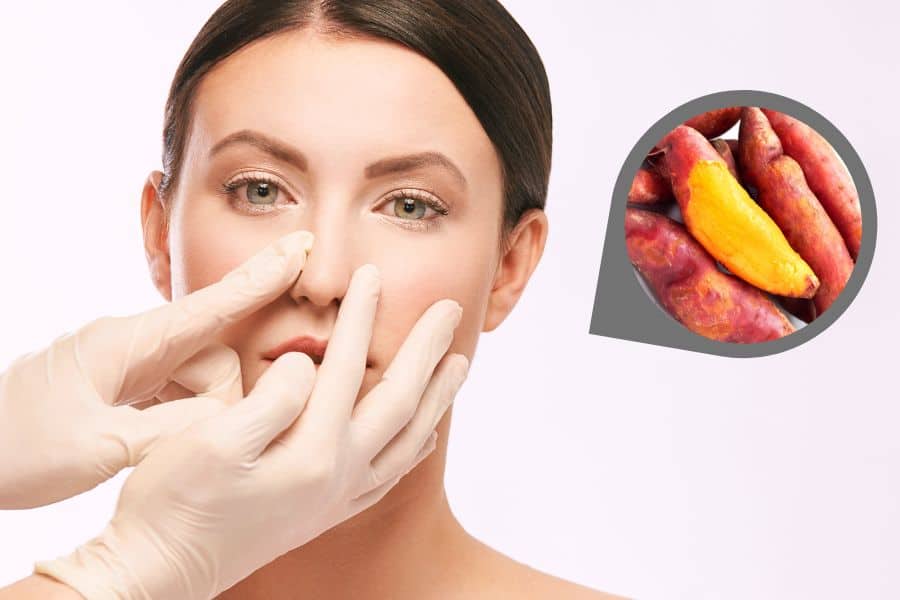 Nâng mũi ăn khoai lang được không? Nên ăn loại khoai nào? 7 nang mui co an duoc khoai lang khong