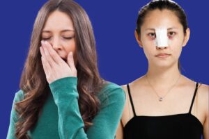 Sau nâng mũi có được ngáp không? Bao lâu thì được ngáp?