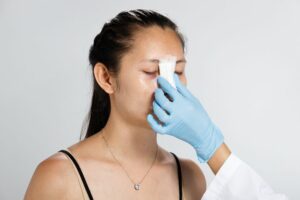 Nâng mũi bao lâu thì được nằm nghiêng? Tham khảo thông tin dưới đây. 