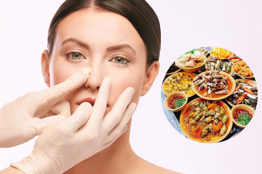 Nâng mũi ăn ốc được không? Không nên ăn ốc sau nâng mũi để quá trình phục hồi diễn ra suôn sẻ hơn
