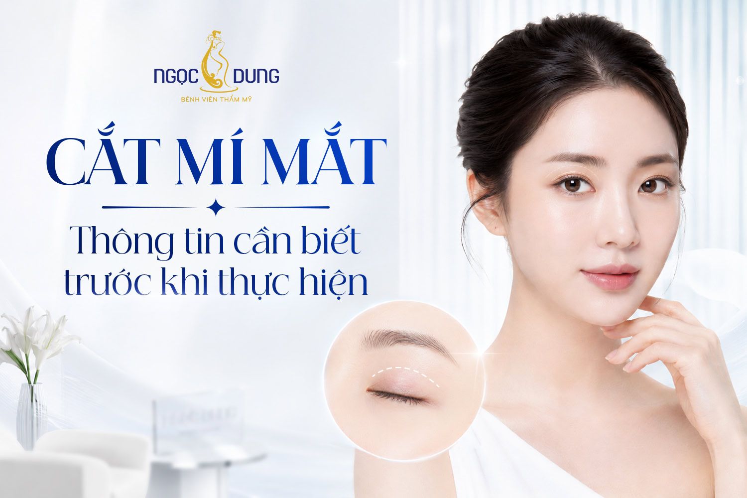 Cắt mí mắt