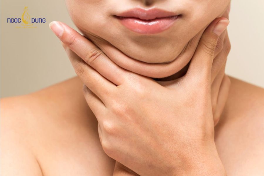 Căng da nọng cằm là gì? Phương pháp và quy trình 2026 11 Các nguyên nhân phổ biến dẫn đến tình trạng cằm đôi, chảy xệ cổ