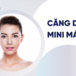 Căng da mini má xệ