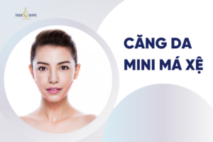 Căng da mini má xệ