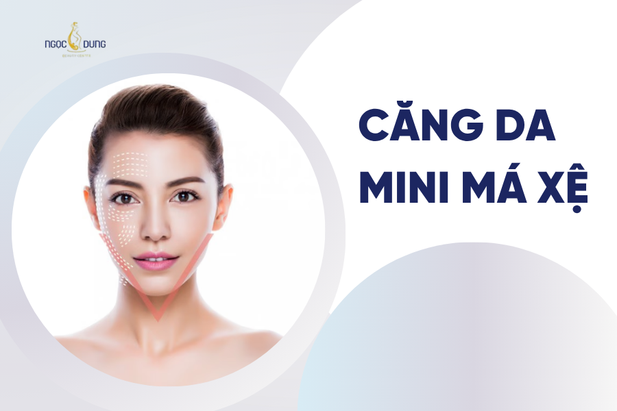Căng da mini má xệ