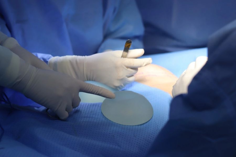 Đặt túi ngực thường mang lại kết quả rõ rệt và ổn định hơn trong thời gian dài