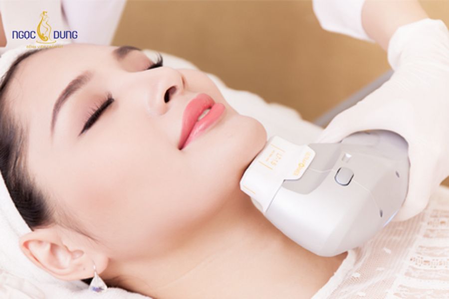 Căng da nọng cằm là gì? Phương pháp và quy trình 2026 12 Nâng cơ xóa nọng cằm bằng công nghệ không xâm lấn
