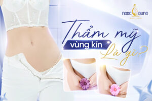 Thẩm mỹ vùng kín